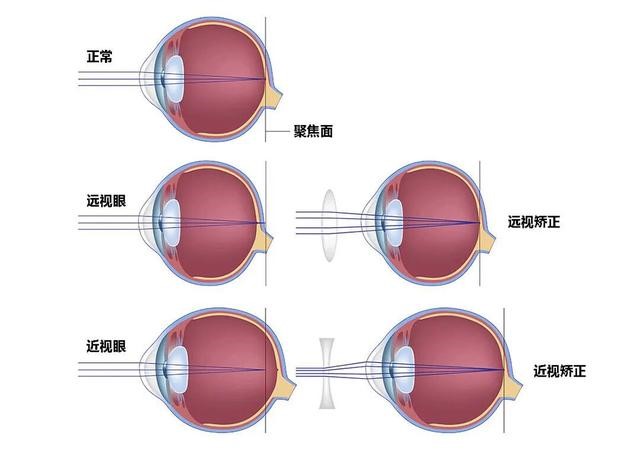 我国儿童青少年近视率过半 3D视觉训练保护视力刻不容缓